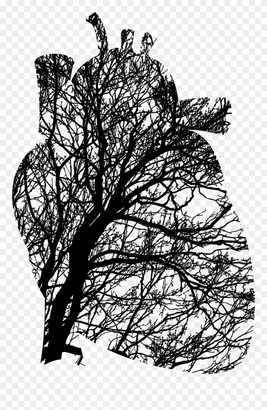 Systolic Blood Pressure In Heart Failure Clipart