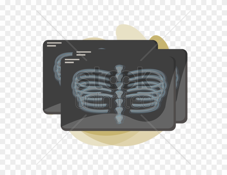 X-ray Of Human Rib Cage V矢量图形 - Thorax Clipart