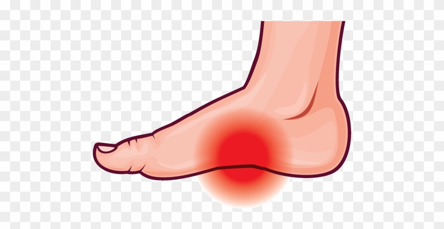 Foot Pain Comfort Plus Shoes Footcare Free Clip Art - Foot Pain Clipart - Png Download