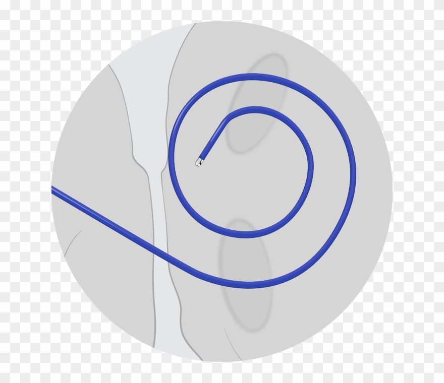 2 Anchor - Ubiquiti Unifi Ap Png Clipart