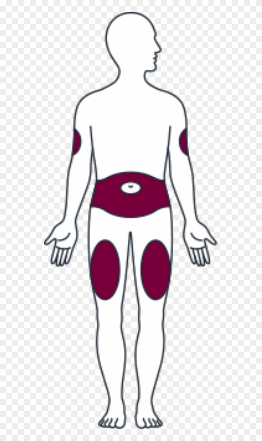 Front Side Appropriate Injection Sites - Humalog Mix 25 Pen 100 Ui Ml Kwikpen 1 Clipart