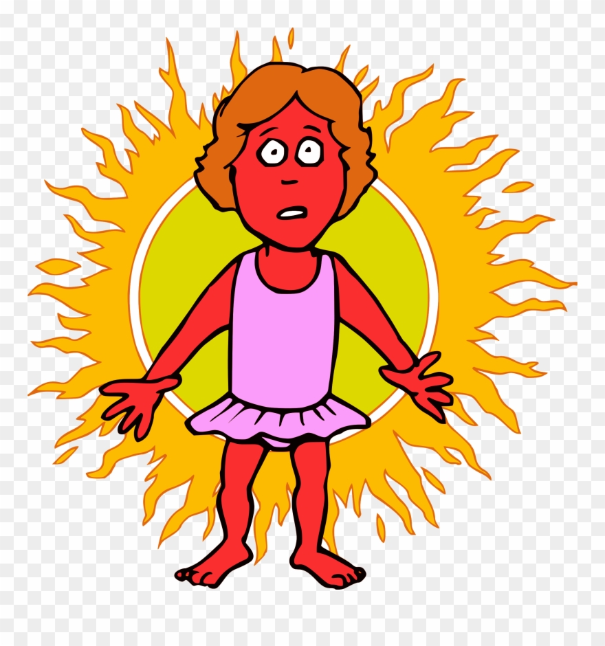 Sunburn Clipart - Png Download