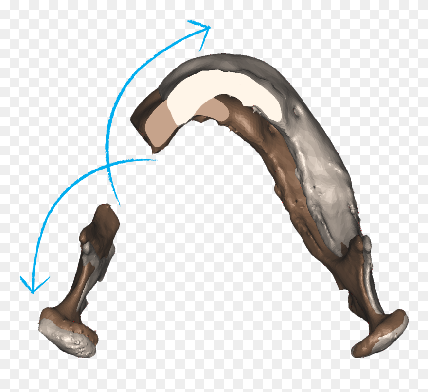 Matching - Surgery Clipart