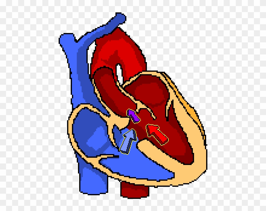 Tetralogy Of Fallot - Portable Network Graphics Clipart