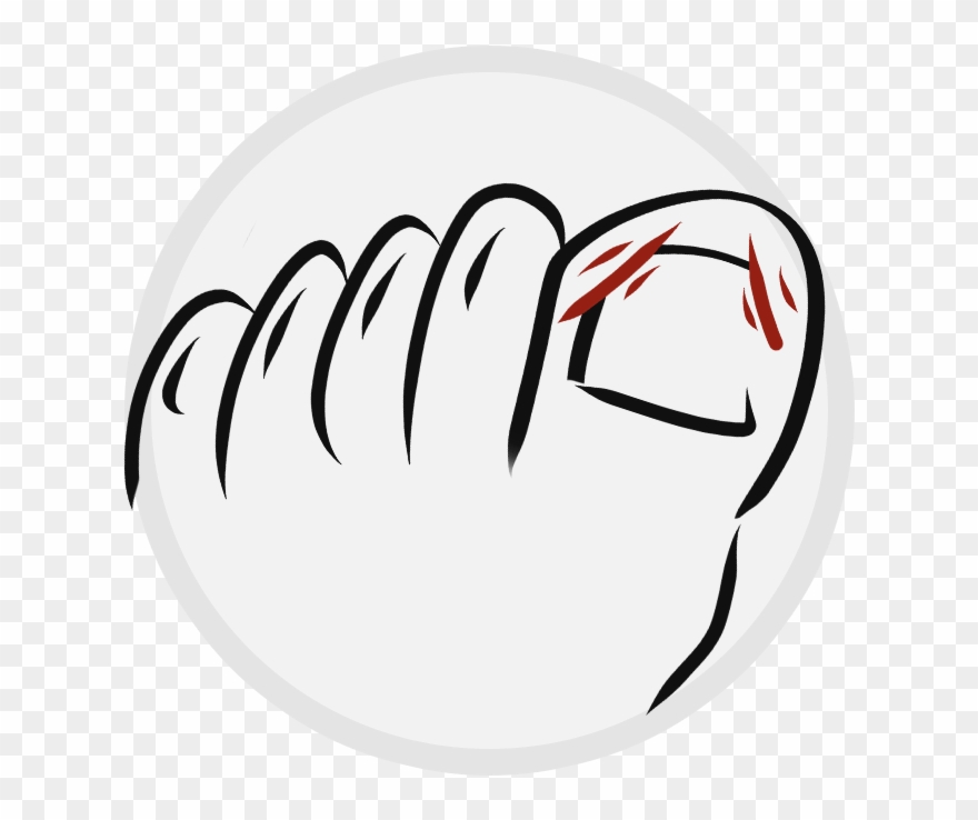Ingrown Nails - Illustration Clipart