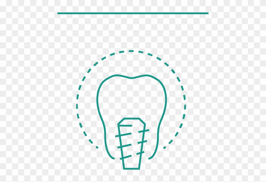 Replacing Missing Teeth With Implants Brings Your Mouth - Illustration Clipart