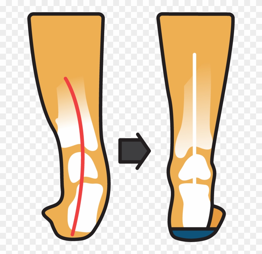 Podsoles Medical Orthotics & Footwear - Medicine Clipart