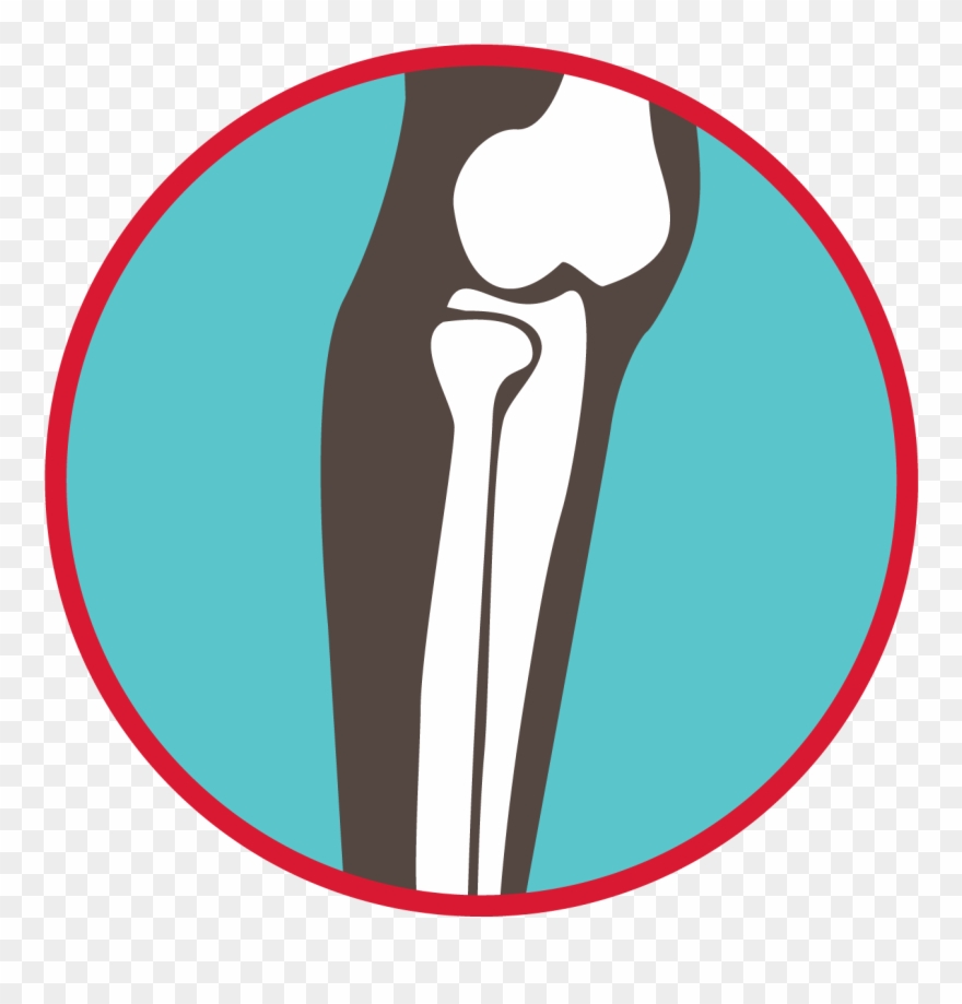 Bones Of The Leg Graphic - Howth Clipart