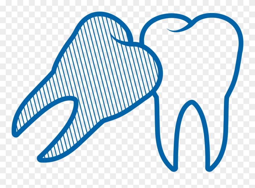 Wisdom Tooth Removal - Human Clipart