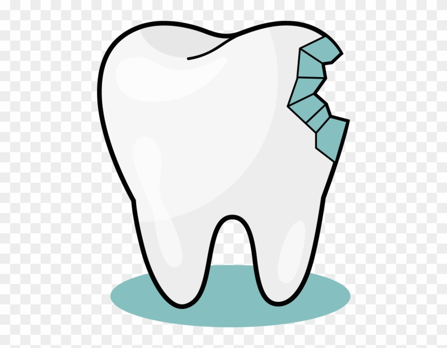 From Small Tender Baby Teeth, To The Wisdom Teeth Causing Clipart