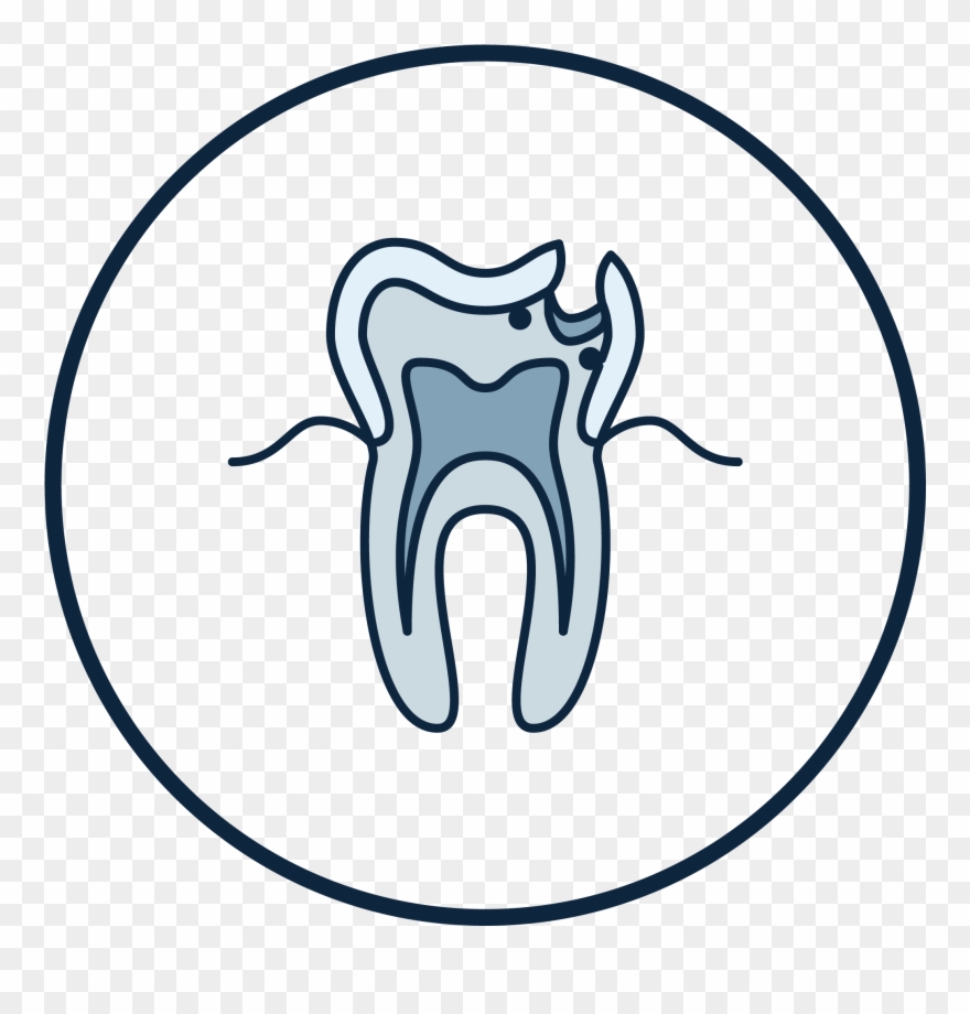 Root Canal Treatment Is Usually A Straightforward Procedure - Dentistry Clipart