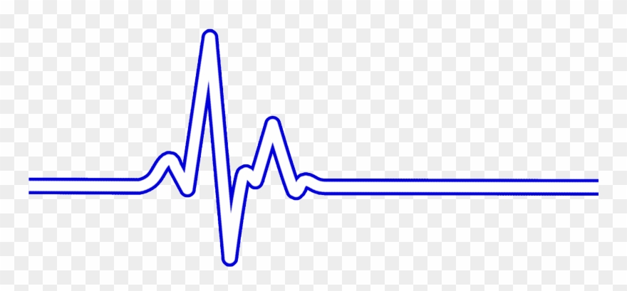 Heart Rate Bpm Ecg Ekg - Electrocardiogramme Png Clipart