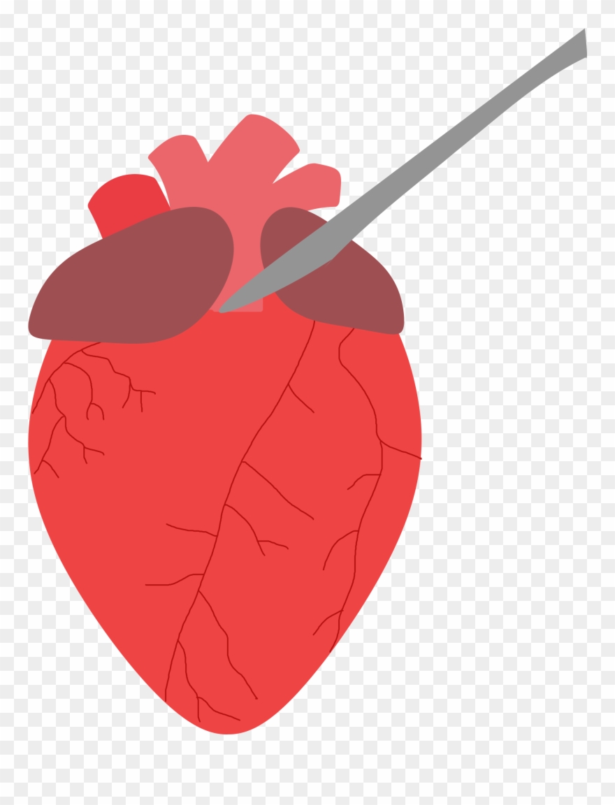Place The Heart So The Anterior Side Is Facing Up - Illustration Clipart