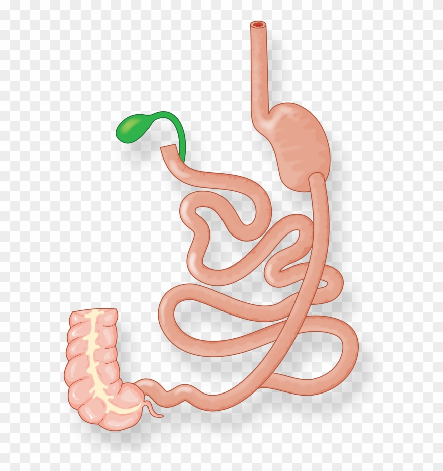 Illustration Of Intestines And Stomach After Duodenal - Duodenal Switch Clipart