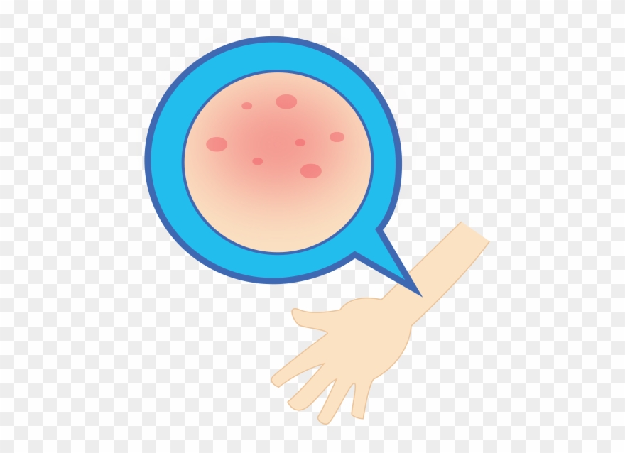 Fioricet Addiction And Rehabilitation Detox To Rehab - Adverse Effect Clipart