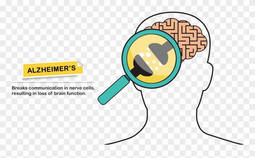 Alzheimer's Neurons Clipart