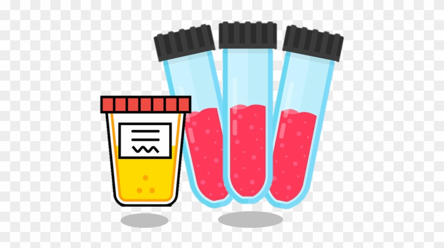 The Gold Standard - Gold Clipart