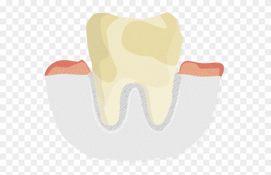 Other Changes In Your Mouth - Tongue Clipart