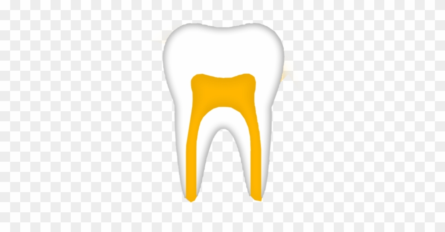 A Root Canal Is A Treatment Used To Repair And Save - Campos Family Dental Pc Clipart