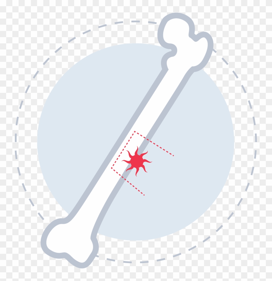 Preoperative Planning - Circle Clipart