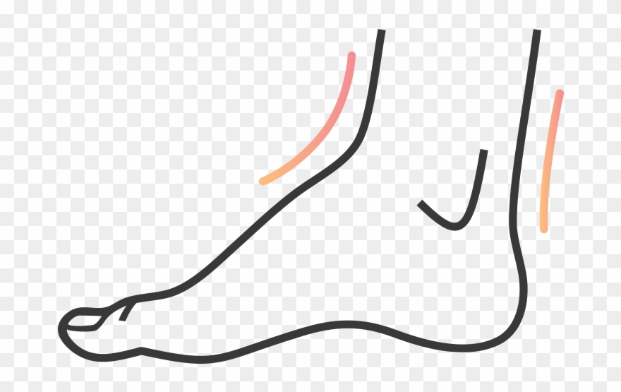 Sprain And Fracture Clipart