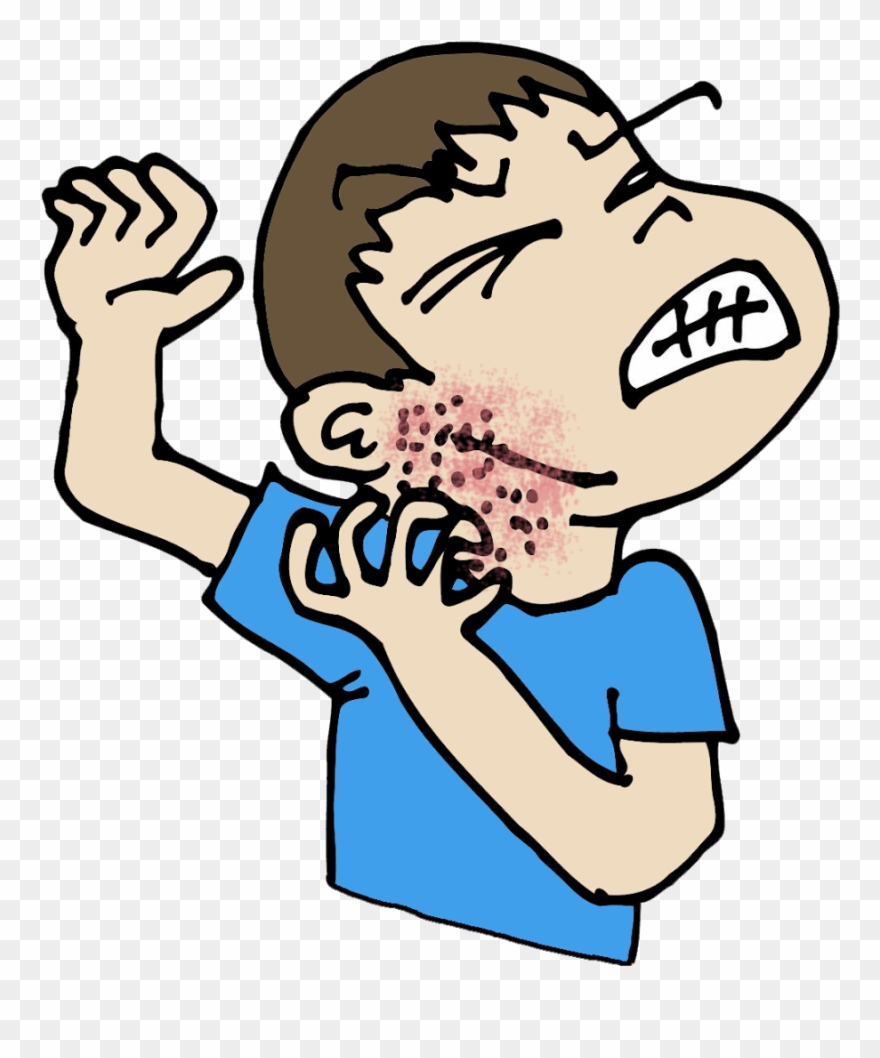 This Represented An Allergy To An Antibiotic Itch Clipart Black And