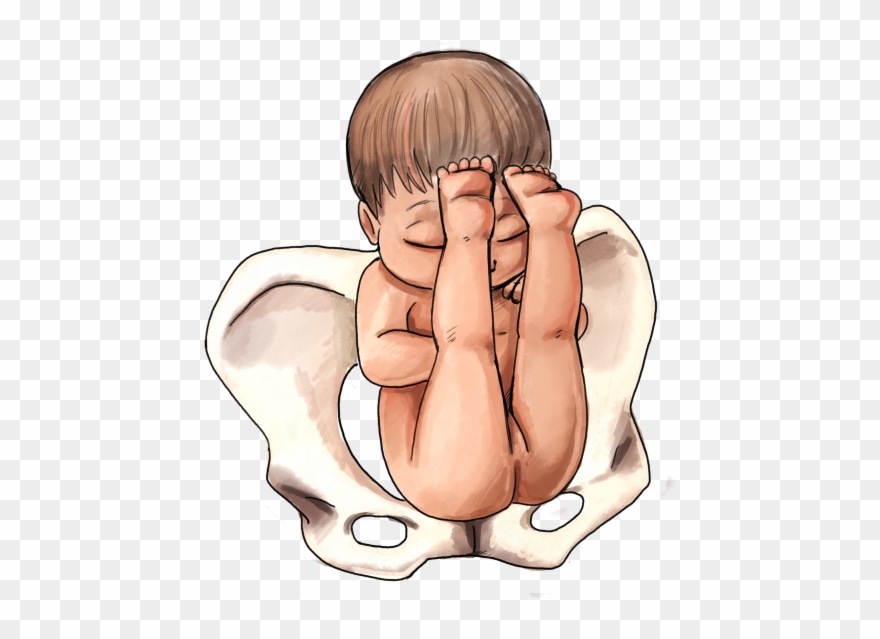 Frank Breech Baby - Extended Breech Clipart