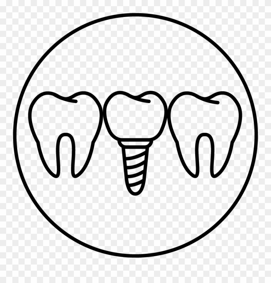 Procedures - Rogue Valley Implant Center Clipart