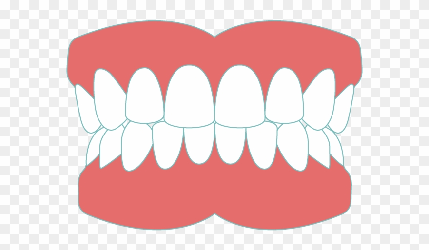 Dentures - Greater Sudbury Clipart