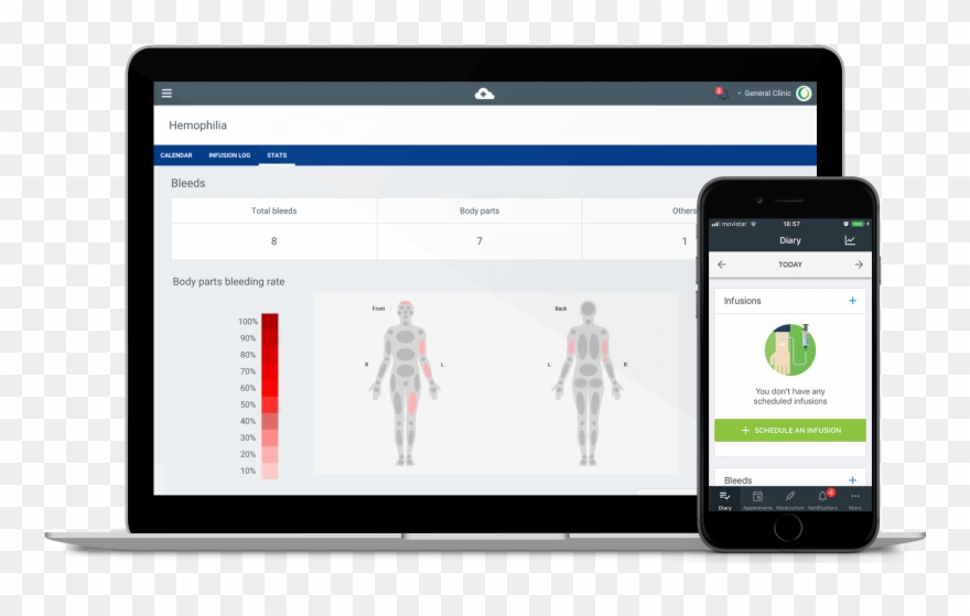 Medtep Hemophilia - Medtep Inc. Clipart
