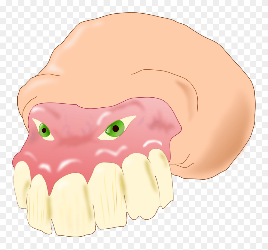 Brushing Teeth Clip Art - Kieferknochenentzündung - Png Download