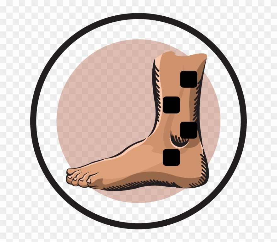 Graphic Black And White Download Electrode Pad Placement - Tens Pad Placement For Ankle Sprains Clipart