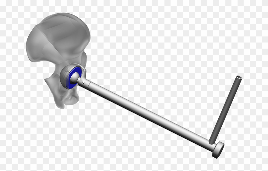 Erweitert1 - Endocon - Produkte - Hueftpfannenschneider - Plunger Clipart