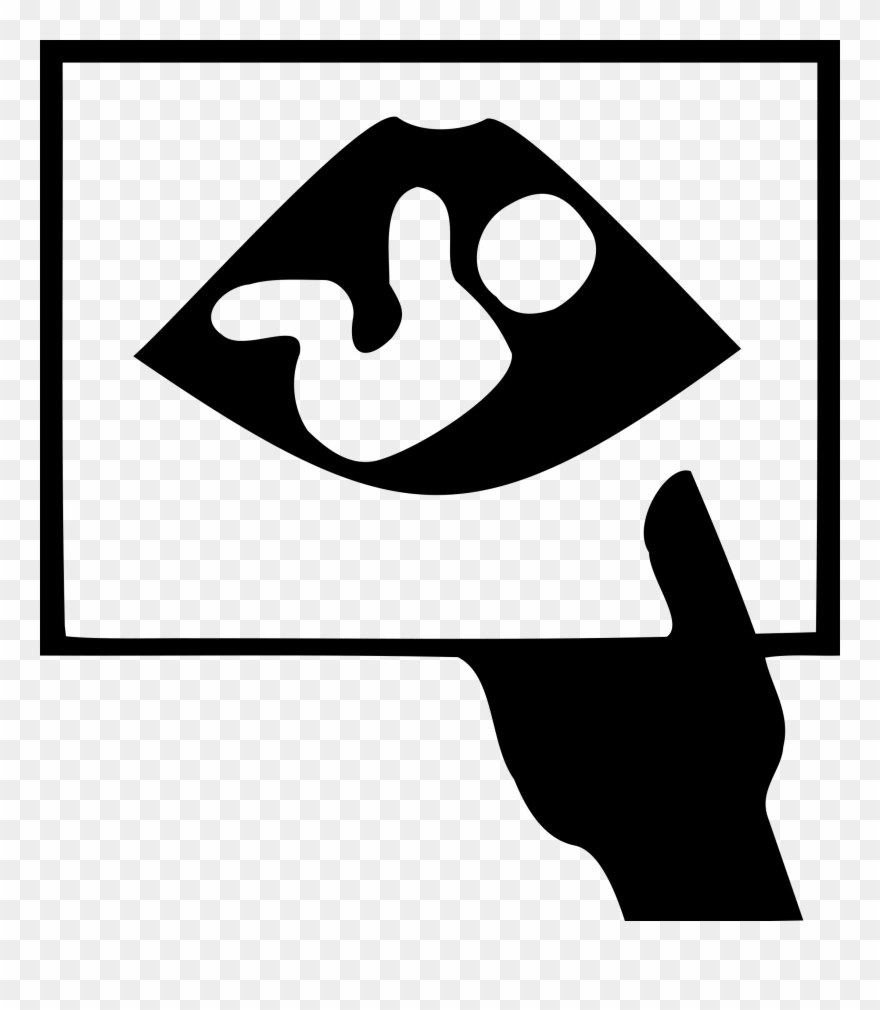 Other Popular Clip Arts - Baby Ultrasound Clipart - Png Download