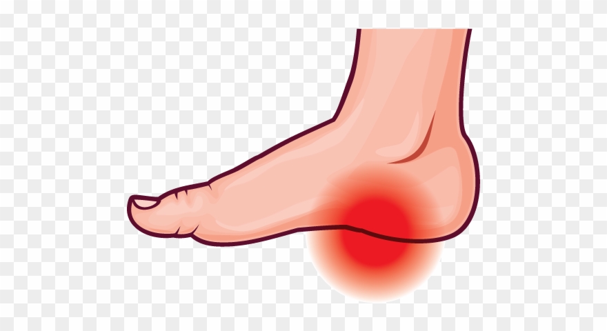 Feet Clipart Ankle - Foot Pain Clipart - Png Download