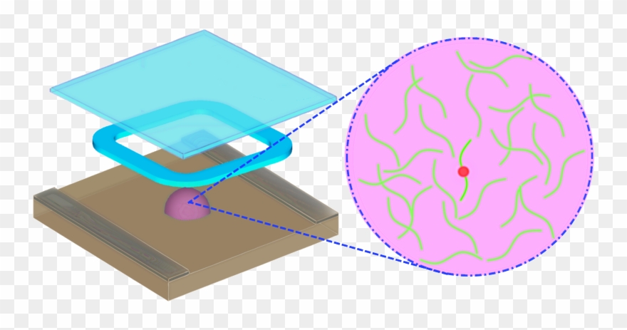 Diagnosis Of Hiv/aids Clipart