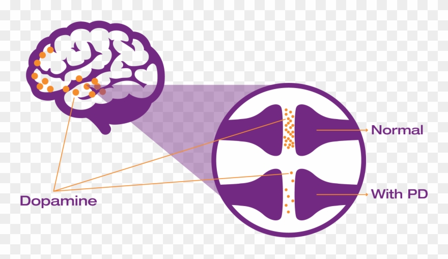 Adding Xadago To Your Levodopa/carbidopa Medicine May - Xadago Improves Motor Symptoms Clipart