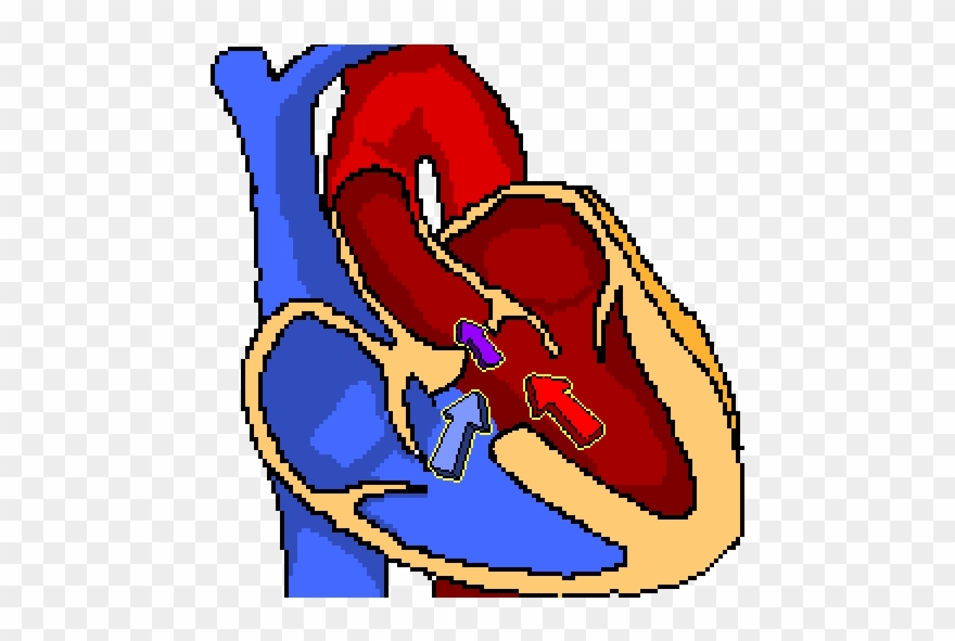 Banner Library Library Bradycardia The Physiologist - Tetralogy Of Fallot Clipart