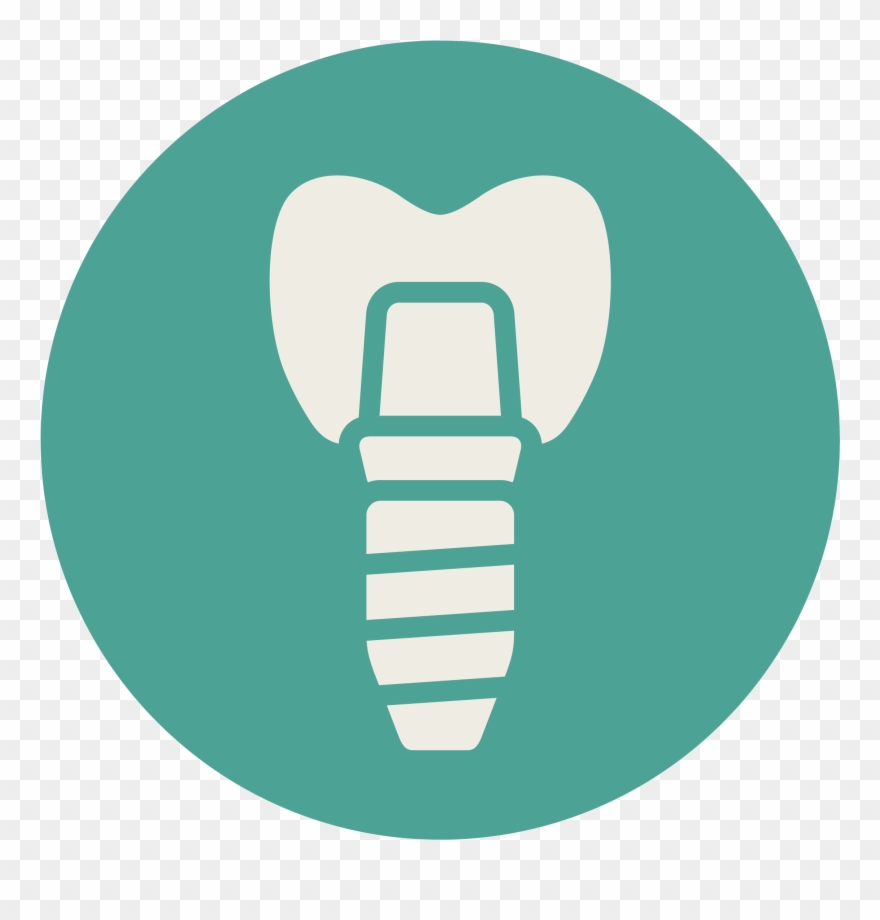 Inplants Dentistry Crestwood Dental Clarkston Michigan - Dentistry Clipart