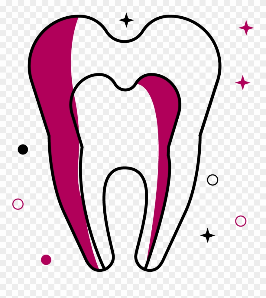 Root Canal Treatment - Root Canal Clipart