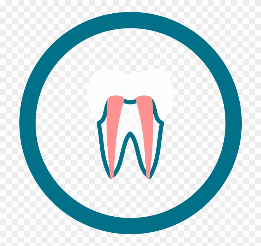 What Is Root Canal Treatment Clipart
