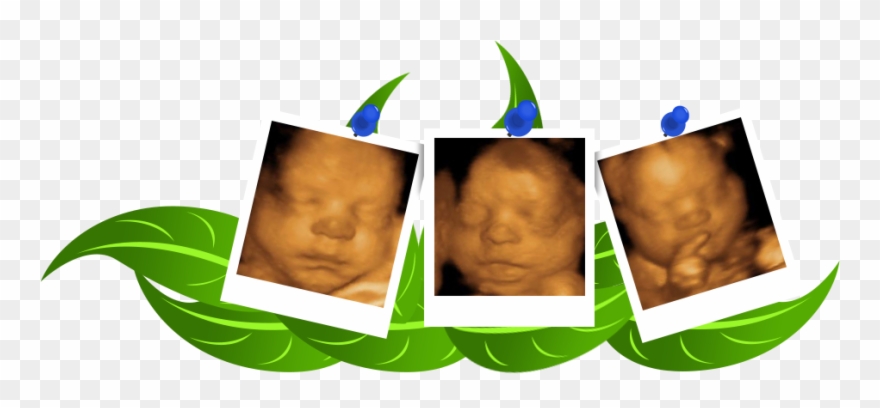 Deluxe Package Clipart