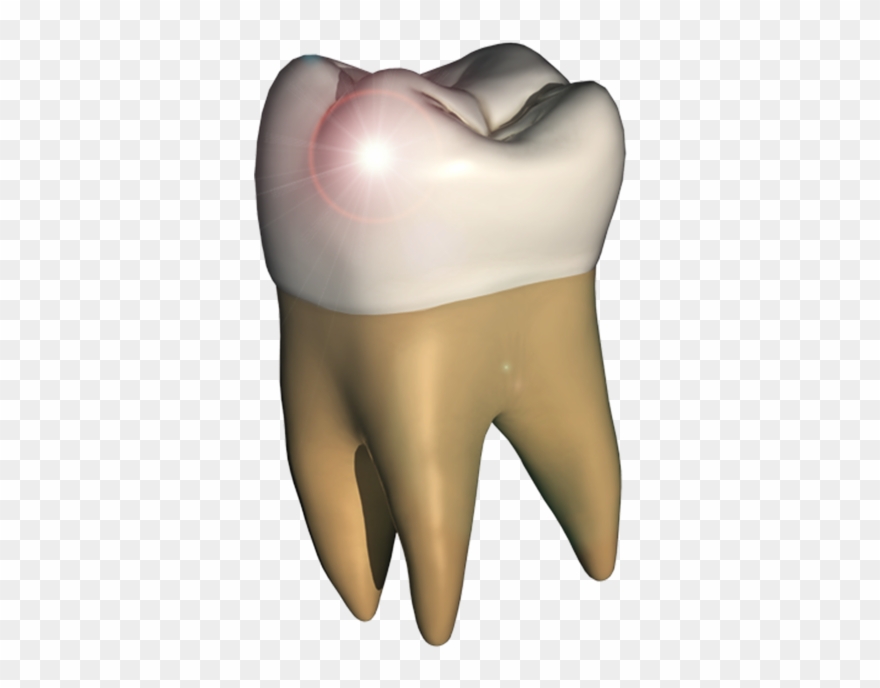 Perfect Tooth Dans Le Mac App Store - Tooth Clipart