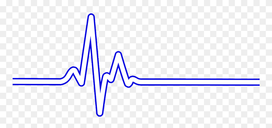 Heart Rate Bpm Ecg U00b7 Free Image On Pixabay - Ekg With Transparent Background Clipart