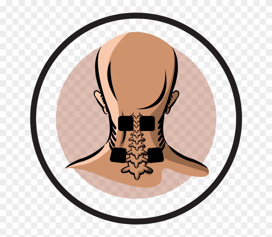Electrode Pad Placement By Body Part Part - Tens Neck Pain Placement Clipart
