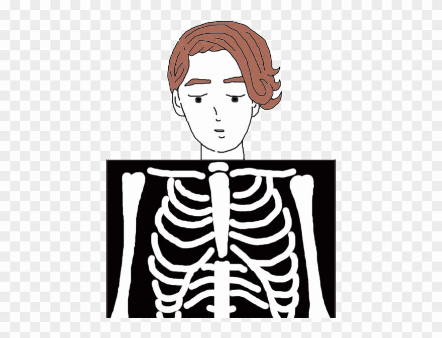 X-ray Clipart