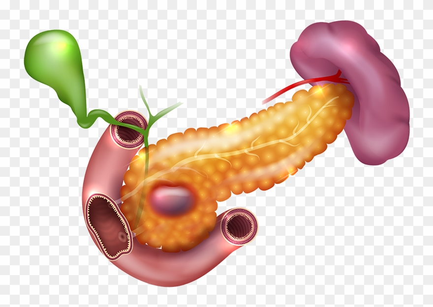 Darkspots In Pancreas - Spleen Liver Clipart
