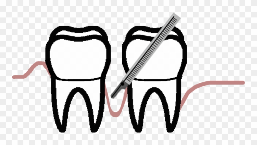 Periodontal Disease Is The Second Largest Cause Of - Periodontology Clipart