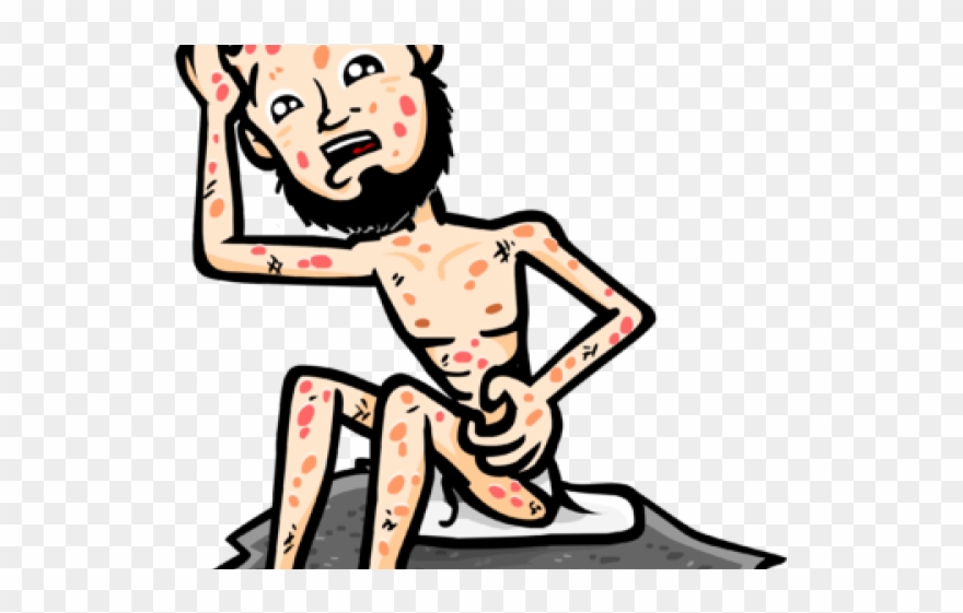 Boils Cliparts - Png Download