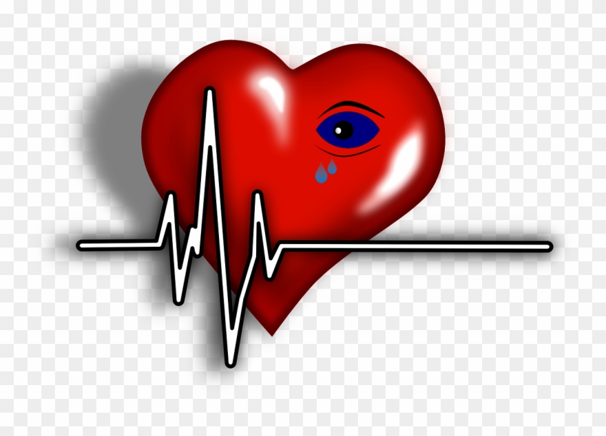 Women Heart Attack Ignored Clipart